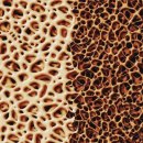 힙스청담의원 이미지