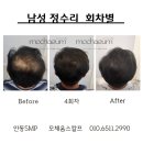 모채움스칼프