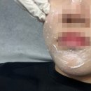 더은뷰티끄(the_eun_beautique) | 광주 스킨플래닝[ 더은뷰티끄 ] 쌍촌동 스킨플래닝으로 깐달걀 피부 만들기