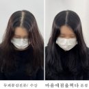 마음에점을찍다두피SMP 이미지