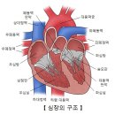 전폐정맥연결 이상 이미지