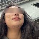 플라덴성형외과 이미지