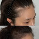 이미지헤어라인 이미지