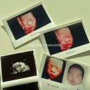 현이초밥 | [10. 임신28주] 대구 입체초음파 베이비페이스 비용 후기, 백일해접종 시기, 임산부 교통사고