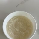 수면 위내시경 대장내시경 후기(플렌뷰산)