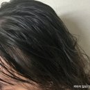 인체 - 리듬 | 출산 육아 후 빠지는 머리카락 헤어리듬 루트너 여성탈모앰플 후기