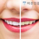 여치과기공소 이미지