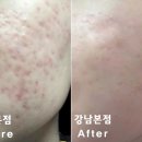 강남리유한의원 네이버블로그