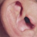 광교 덴마크보청기 이미지