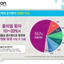 아쿠아몰드 이미지