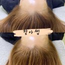 김헤어라인 이미지