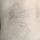 신미헤어라인 | [안중]신미하다/발 뒤꿈치케어/헤어라인 왁싱/ 겨드랑이 왁싱