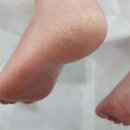 아코네일 이미지