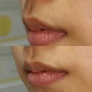 신촌 왁싱 &lt;마벨왁싱 &gt; 꿀페이스 왁싱 솔직후기