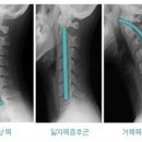 목담 이미지