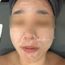 봉영로 | 영통피부관리 수분 영양 속건조 피부영양제 내돈내산 솔직후기