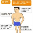 금양체질 이미지