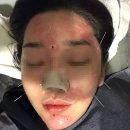 용한의원 | 리유한의원 가격 궁금하신 가용? &gt;&gt;신사점&lt;&lt; 기준으로 정리해봐용