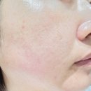 니들샷 에센스 제대로 느껴본 후기, 닥터 제이에스케이 PDRN 모공 에센스 솔직 리뷰