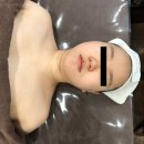 화이트테라피