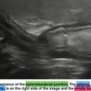 Feline abdominal ultrasonography_ What’s normal What’s abnormal_ normal gastrointestinal tract 이미지