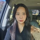 글래드보아 | 대구 입술필러 잘하는곳 글래드성형외과 내돈내산 찐후기