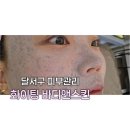 진바이오 - 남동구 백범로 322 | 송현동피부관리 바이오필링 후기 (ft.약초 필링)
