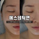 [중화] 1:1 맞춤 피부관리 &#39;에스테틱연&#39; 중랑구에스테틱 추천 및 후기