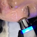 강동-천호-2438 | 둔촌동 기미잡티! 미작뷰티 강동점에서 클리어스팟프로 3회차까지 받은 솔직 후기! 맑은 피부로 자신감...