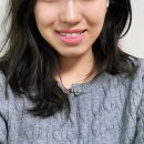 스마일100치과의원 | 잇몸성형, 거미스마일 보톡스 4주 후기