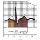 심장박동검사 이미지