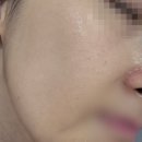 소몽 | 뤼산느 소몽 에센젤 사용후기