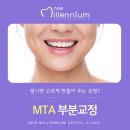 뉴밀레니엄치과의원 네이버블로그
