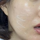 한성약국 | 해외에서 난리난 약국화장품 PDRN크림 사용후기