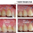 바른손치과 이미지
