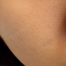 지성정비 | 원주 무실동[올리다에스테틱]피부관리 추천| 모공관리 받고온 솔직 후기