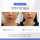 연세미니성형외과의원 | 평택성형외과｜결국 ‘눈에 보이지 않는 디테일’이 결과를 결정합니다