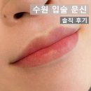 봉담장항외과의원 | 수원 입술문신 자연스러운 입술 잘하는곳, 내돈내산 솔직후기