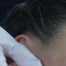 메디스킨유리하
