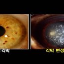 아이앤유안경콘택트 이미지