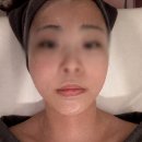 선암초등학교 | 대전 에스테틱 끌리메 관저점에서 작은얼굴 관리받고 온 솔직후기