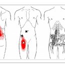 Iliopsoas (장요근) 이미지