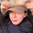 루비약국 | 내돈내산 루비레이저 주근깨 제거 비포 애프터 후기 / 관리방법, 꿀팁 등(+2개월이 지난 지금 .. )