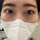은하수안과의원 네이버블로그