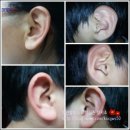 귀건강상담학 이미지