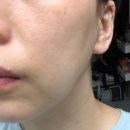 디어민하우스 | [ 인셀덤 ] 기초라인 일주일 사용후기