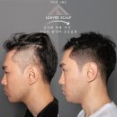 30대 남성 탈모 고민, 광명·여의도 고객님의 리얼한 변화｜M자·정수리 디자인 후기