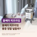 강북 노원구 울쎄라 피프라임 후기, 통증 줄고 시술시간 짧아진 이유