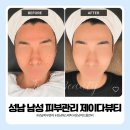 비니뷰티 | 성남 남자 피부관리, 소개팅 전 동생과 다녀온 제이다뷰티 후기