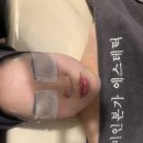 미인개 | 서울 목동 에스테틱: 미인본가 목동점 얼굴비대칭+슬리밍 다이어트 후기